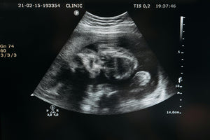 NHS Fetal Anomaly Screening Programme (FASP)