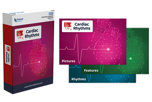 PAIR-UP Cardiac Rhythms